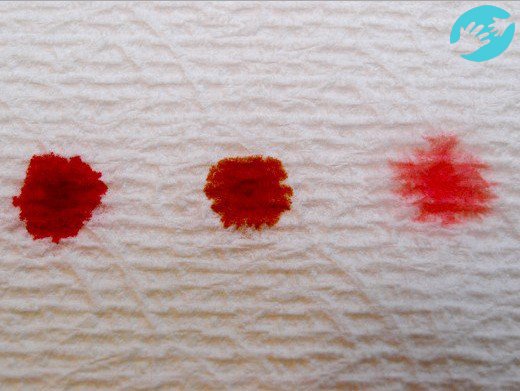 Такие следы кровяных выделений во время и после овуляции должны насторожить женщину