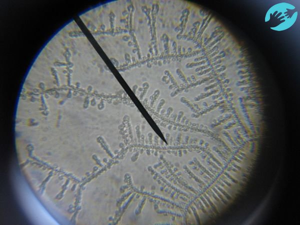 Сколько живет яйцеклетка - определеяем с помощью микроскопа