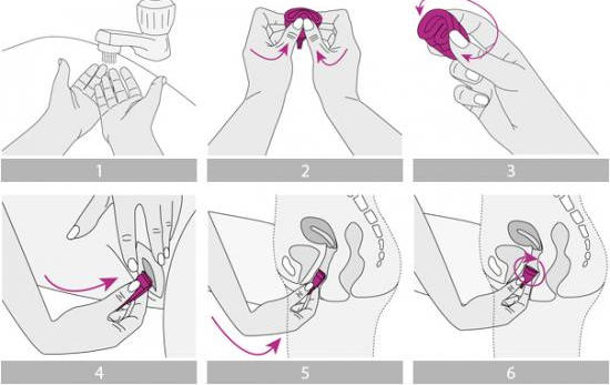 Воспользуйтесь менструальной капой, выбрав подходящий размер, соблюдая привала гигиены: обязательно нужно вымыть руки, сложить капу вдвое и ввести капу. Если остались вопросы как пользоваться? Требуется подробно изучить схему введения капы
